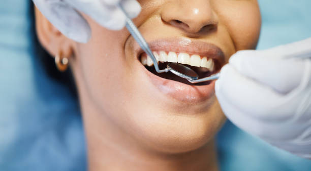 Best Emergency Tooth Extraction in Gunnison, UT
